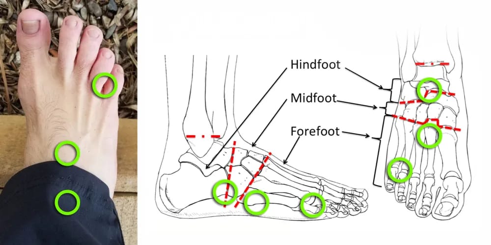 Diagram of foot pressure points used in Japanese reflexology